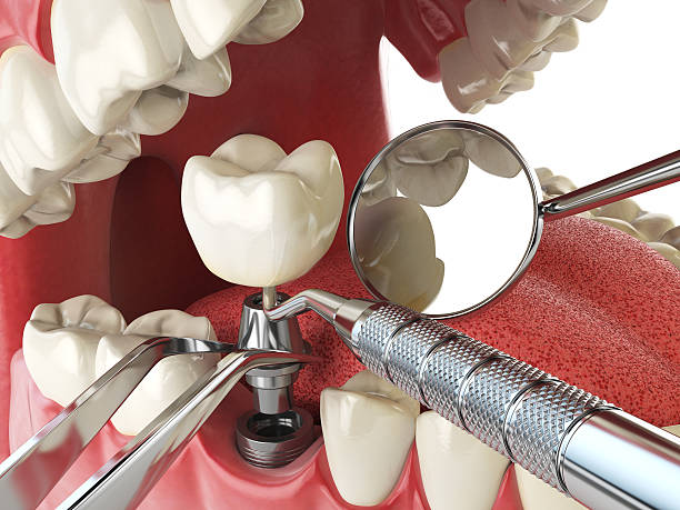 Best Orthodontic Emergency Dentist in Springfield, FL